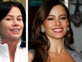 Sofia Vergara before and after cosmetic procedures