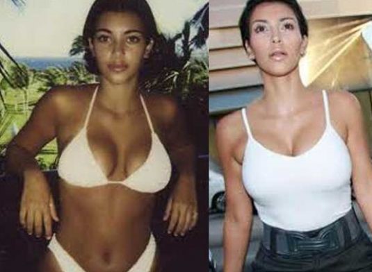 Kim Kardashian before and after breast augmentation