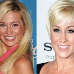 Kellie Pickler before and after plastic surgeryKellie Pickler before and after plastic surgery