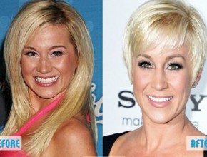 Kellie Pickler before and after plastic surgeryKellie Pickler before and after plastic surgery