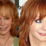 Reba McEntire before and after plastic surgery