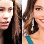 Sofia Vergara before and after plastic surgery