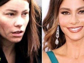 Sofia Vergara before and after plastic surgery