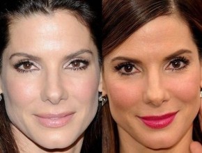 Sandra Bullock before and after cosmetic procedures