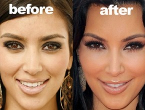 Kim Kardashian before and after face change