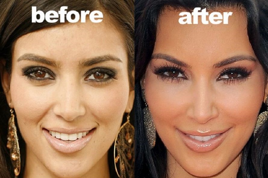 Kim Kardashian before and after face change