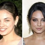 Mila Kunis before and after plastic surgery