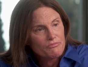 Caitlyn - Bruce Jenner before plastic surgery