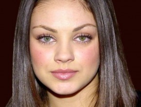 Mila Kunis plastic surgery