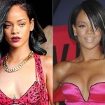 Rihanna before and after plastic surgery 1313