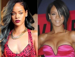 Rihanna before and after plastic surgery 1313