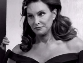 Caitlyn Jenner (Bruce) after plastic surgery