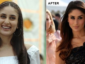 Kareena Kapoor before and after plastic surgery
