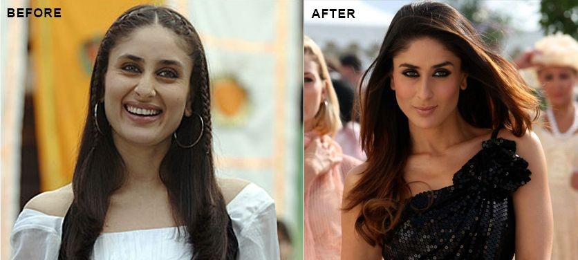 Kareena Kapoor before and after plastic surgery
