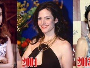 Mary Louise Parker before and after plastic surgery