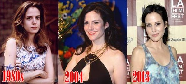 Mary Louise Parker before and after plastic surgery