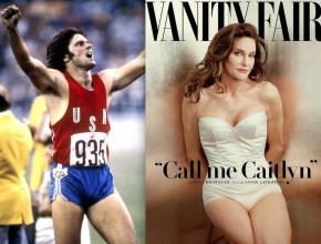 Caitlyn - Bruce Jenner  before and after plastic surgery