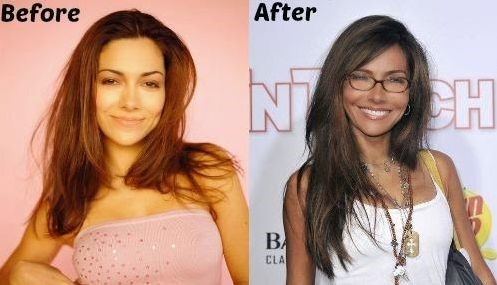 Vanessa Marcil before and after plastic surgery