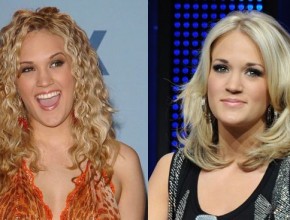 Carrie Underwood before and after plastic surgery