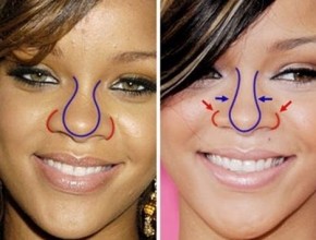 Rihanna before and after plastic surgery 117