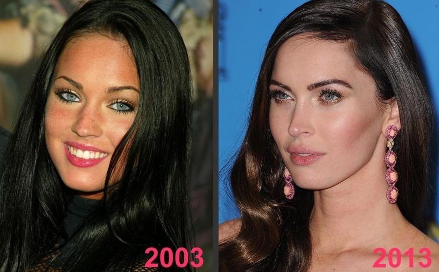 Megan Fox before and after plastic surgery