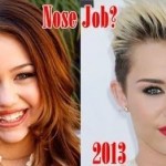 Miley Cyrus before and after plastic surgery