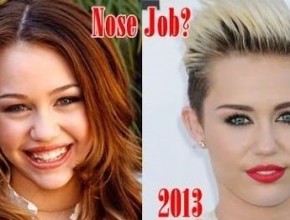 Miley Cyrus before and after plastic surgery