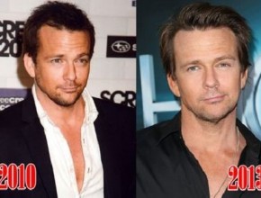 Sean Patrick Flanery before and after plastic surgery