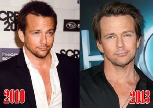 Sean Patrick Flanery before and after plastic surgery