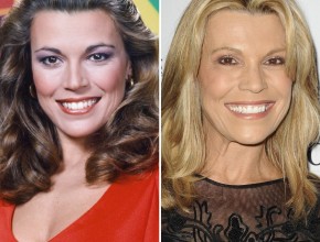 Vanna White before and after plastic surgery