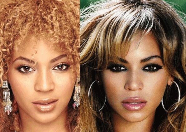 Beyonce before and after plastic surgery