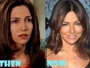 Vanessa Marcil before and after plastic surgery