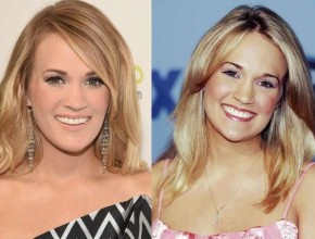Carrie Underwood before and after plastic surgery