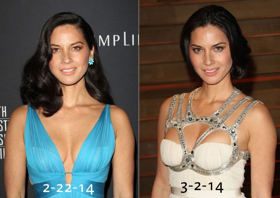 Lisa Olivia Munn before and after plastic surgery