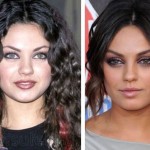 Mila Kunis before and after plastic surgery