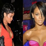 Rihanna before and after plastic surgery 215