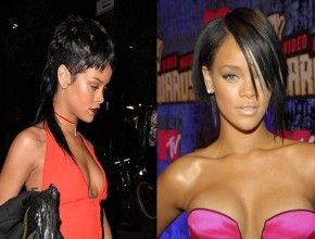Rihanna before and after plastic surgery 215