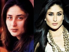 Kareena Kapoor before and after plastic surgery