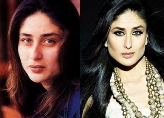 Kareena Kapoor before and after plastic surgery