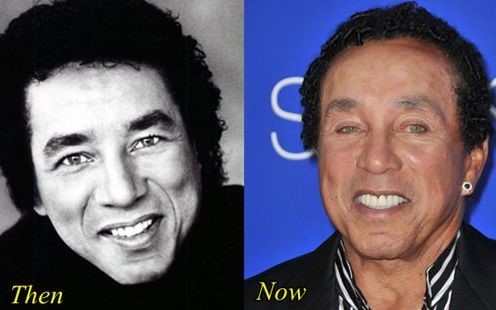 Smokey Robinson before and after plastic surgery