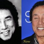 Smokey Robinson before and after plastic surgery