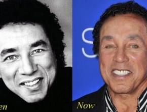 Smokey Robinson before and after plastic surgery