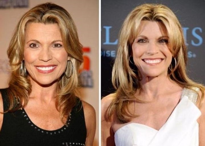 Vanna White before and after plastic surgery