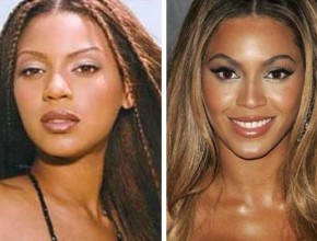 Beyonce before and after plastic surgery