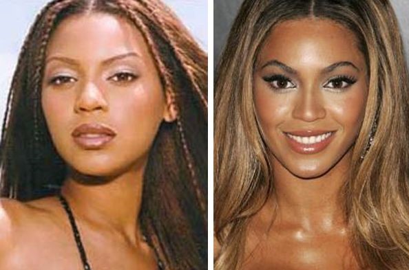 Beyonce before and after plastic surgery