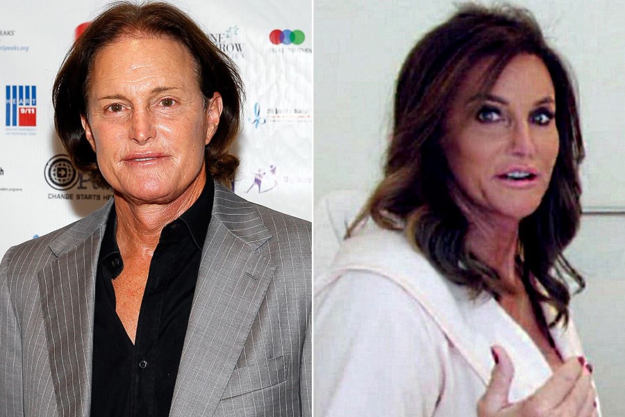 Caitlyn - Bruce Jenner before and after plastic surgery