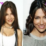 Vanessa Marcil before and after plastic surgery