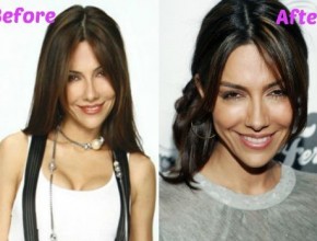 Vanessa Marcil before and after plastic surgery