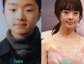 Seo Woo before and after plastic surgery