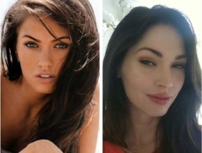 Megan Fox before and after plastic surgery